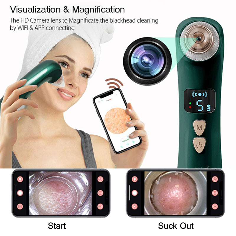 Heating Blackhead Instrument Visualizing Blackhead Instrument Rechargeable Pore Cleaner