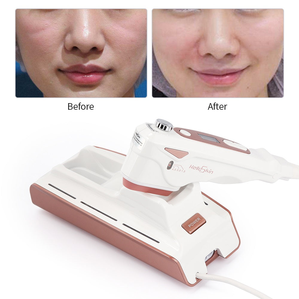 Home V Face Lifting Ultrasonic Lifting Anti-aging Beauty Instrument