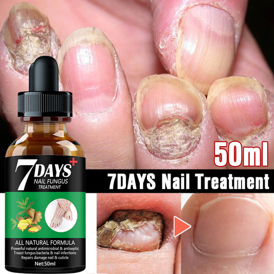 7 DAY  Nail Fungus Treatment Serum Care Hand And Foot Care Removal